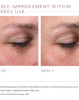 Biopelle Emepelle Eye Cream 15ml