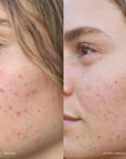 Saya AHA Micro Exfoliator 100ml