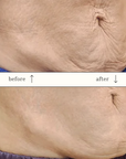 Profhilo Figura Body Cream