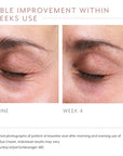 Biopelle Emepelle Eye Cream 15ml